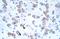 Cation Channel Sperm Associated 2 antibody, A08041, Boster Biological Technology, Immunohistochemistry paraffin image 
