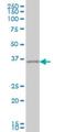 Cone-Rod Homeobox antibody, H00001406-M04, Novus Biologicals, Western Blot image 