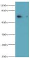 PKG antibody, LS-C377477, Lifespan Biosciences, Western Blot image 