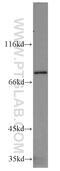Receptor-interacting serine/threonine-protein kinase 1 antibody, 17519-1-AP, Proteintech Group, Western Blot image 