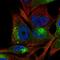 Tyrosinase antibody, HPA050889, Atlas Antibodies, Immunofluorescence image 