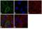 Vimentin antibody, MA5-11883, Invitrogen Antibodies, Immunofluorescence image 