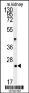 LHFPL Tetraspan Subfamily Member 3 antibody, 62-020, ProSci, Western Blot image 