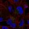 Family With Sequence Similarity 78 Member B antibody, HPA073246, Atlas Antibodies, Immunofluorescence image 
