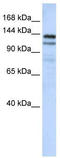 NODAL Modulator 1 antibody, TA334506, Origene, Western Blot image 