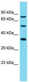 DDB1 And CUL4 Associated Factor 8 Like 2 antibody, TA335896, Origene, Western Blot image 