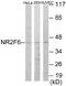 Nuclear Receptor Subfamily 2 Group F Member 6 antibody, EKC1675, Boster Biological Technology, Western Blot image 