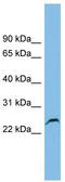 Glutathione S-transferase kappa 1 antibody, TA333789, Origene, Western Blot image 