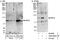 Mitogen-activated protein kinase 6 antibody, A302-654A, Bethyl Labs, Immunoprecipitation image 