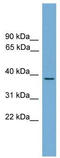 Heat shock factor protein 3 antibody, TA329601, Origene, Western Blot image 