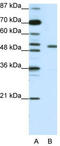 Potassium Voltage-Gated Channel Subfamily A Regulatory Beta Subunit 2 antibody, TA331456, Origene, Western Blot image 