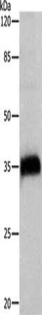 Cathepsin Z antibody, CSB-PA577887, Cusabio, Western Blot image 