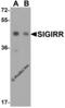 Single Ig And TIR Domain Containing antibody, 3367, ProSci, Western Blot image 