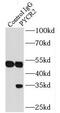 Pyrroline-5-Carboxylate Reductase 2 antibody, FNab06971, FineTest, Immunoprecipitation image 