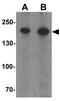 Phlpp antibody, GTX31861, GeneTex, Western Blot image 