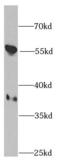 Protein Phosphatase 1 Catalytic Subunit Beta antibody, FNab06694, FineTest, Western Blot image 