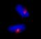 Centrosomal Protein 170 antibody, IHC-00265, Bethyl Labs, Immunofluorescence image 