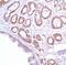 Xenotropic murine leukemia virus antibody, PA5-32642, Invitrogen Antibodies, Immunohistochemistry frozen image 
