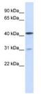 Transmembrane Serine Protease 11A antibody, NBP1-62546, Novus Biologicals, Western Blot image 