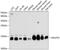 NADH:Ubiquinone Oxidoreductase Subunit S5 antibody, GTX55723, GeneTex, Western Blot image 