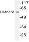 LIM Domain Kinase 1 antibody, AP20986PU-N, Origene, Western Blot image 