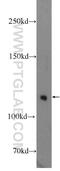 Tubulin Gamma Complex Associated Protein 5 antibody, 14620-1-AP, Proteintech Group, Western Blot image 
