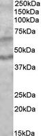 Hedgehog Acyltransferase antibody, EB10670, Everest Biotech, Western Blot image 