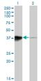 Homeobox protein Hox-B5 antibody, H00003215-M01, Novus Biologicals, Western Blot image 