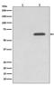 Protein Kinase AMP-Activated Catalytic Subunit Alpha 2 antibody, P01420, Boster Biological Technology, Western Blot image 