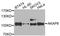 A-Kinase Anchoring Protein 8 antibody, A3049, ABclonal Technology, Western Blot image 