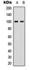 Vav Guanine Nucleotide Exchange Factor 2 antibody, LS-C368550, Lifespan Biosciences, Western Blot image 