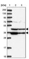 Proteasomal ATPase Associated Factor 1 antibody, PA5-59008, Invitrogen Antibodies, Western Blot image 