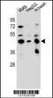 Leucine Rich Repeat Containing 28 antibody, 56-485, ProSci, Western Blot image 