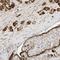 PTK6 antibody, HPA036070, Atlas Antibodies, Immunohistochemistry frozen image 