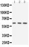 Solute Carrier Family 22 Member 3 antibody, PA2173, Boster Biological Technology, Western Blot image 