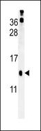 Group XVI phospholipase A2 antibody, 62-032, ProSci, Western Blot image 