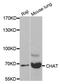 Choline O-Acetyltransferase antibody, A2495, ABclonal Technology, Western Blot image 