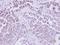Phosphoethanolamine/phosphocholine phosphatase antibody, GTX119275, GeneTex, Immunohistochemistry paraffin image 