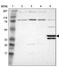 Pleckstrin 2 antibody, PA5-51538, Invitrogen Antibodies, Western Blot image 