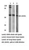 Protein kinase B antibody, AP06620PU-N, Origene, Western Blot image 