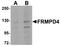 Transmembrane Protein 94 antibody, A15565, Boster Biological Technology, Western Blot image 