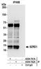 SUZ RNA Binding Domain Containing 1 antibody, A304-742A, Bethyl Labs, Immunoprecipitation image 