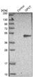 Glutaminyl-Peptide Cyclotransferase antibody, PA5-52554, Invitrogen Antibodies, Western Blot image 