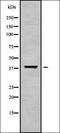 Acyl-CoA Dehydrogenase Family Member 11 antibody, orb337943, Biorbyt, Western Blot image 