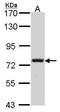 Calpain-5 antibody, PA5-21934, Invitrogen Antibodies, Western Blot image 