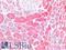 Cathepsin S antibody, LS-B16887, Lifespan Biosciences, Immunohistochemistry paraffin image 