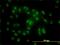 Proteasome 26S Subunit, ATPase 6 antibody, H00005706-M02, Novus Biologicals, Immunocytochemistry image 