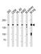 Plakophilin 4 antibody, PA5-35286, Invitrogen Antibodies, Western Blot image 