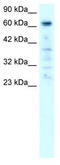 Poly(ADP-Ribose) Polymerase Family Member 3 antibody, TA334263, Origene, Western Blot image 