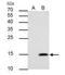 Galectin 7B antibody, NBP2-16584, Novus Biologicals, Immunoprecipitation image 